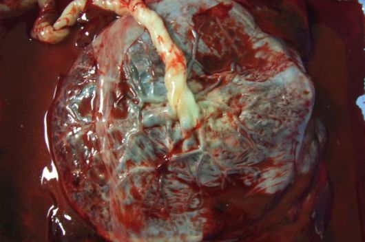 The human placenta