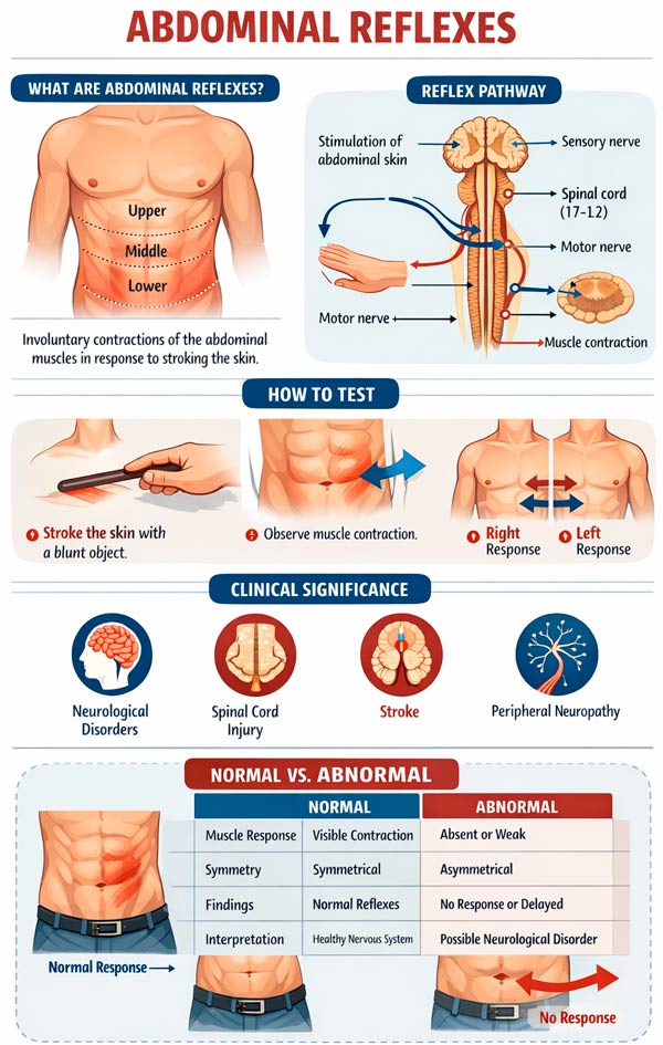 Abdominal reflexes: how they are tested, what is considered normal, and ...