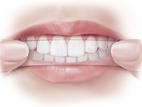 How to use whitening strips for teeth?