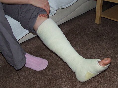 Measures at home with fracture of legs