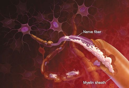How Multiple Sclerosis Works