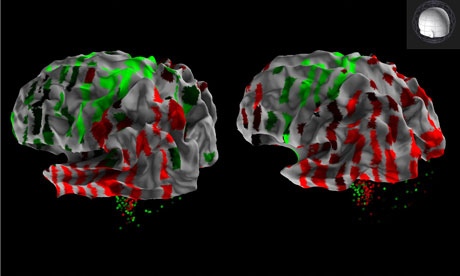 Created the world's first atlas of the human brain