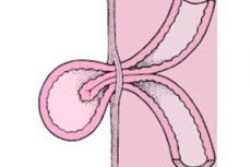 Intestinal strangulation: symptoms, diagnosis and emergency treatment ...