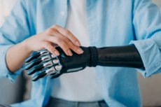 Proesis Limb prosthetics: types of prostheses, selection, rehabilitation and ...