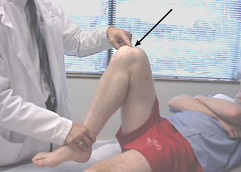 Pain in the knee during flexion is the most common reason why people visit trauma doctors. 