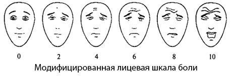 Modified Facial Pain Scale