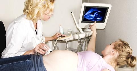 Women increasingly decide to do cesarean section